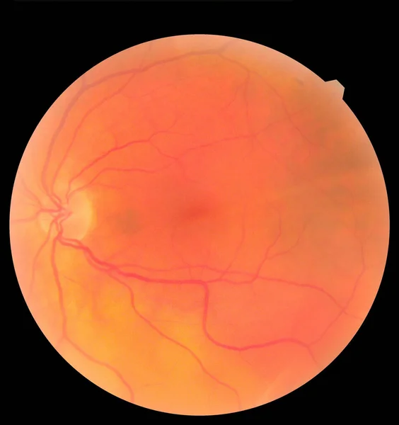 Szemészeti kép, amely részletezi a retinát és a látóideget az egészséges emberi szem belsejében. Egészségvédelmi koncepció — Stock Fotó