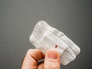 Makro çekim grubun erkek elinde epilated el saç ve kan nokta içeren bandaj ile yardım