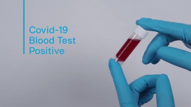 Mavi eldivenli doktor elleri ve koronavirüsü temsil eden PPE giysisi ya da 2019-ncov veya covid-19 pandemik tarama testi pozitif sonuç veya enfeksiyon kapmış 