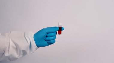 Mavi eldivenli doktor elleri ve koronavirüsü temsil eden PPE giysisi ya da 2019-ncov veya covid-19 pandemik tarama testi pozitif sonuç veya enfeksiyon kapmış 