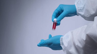 Mavi eldivenli doktor elleri ve koronavirüsü temsil eden PPE giysisi ya da 2019-ncov veya covid-19 pandemik tarama testi pozitif sonuç veya enfeksiyon kapmış 