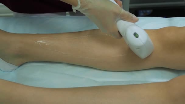 Laser hair removal on ladies legs. The girl is lying on the couch in the medical glasses in the treatment room. The hands of the cosmetologist make the epilation of the legs — Stock Video