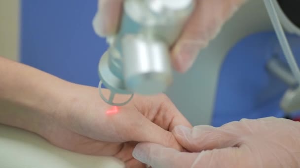 Medico cosmetologo fa la procedura di rimozione della cicatrice laser. Concetto di ringiovanimento della pelle, cosmetologia hardware . — Video Stock