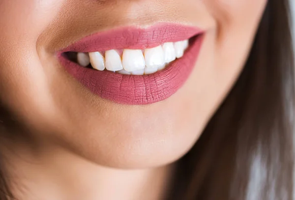 Fechar-se de uma bela mulher sorridente com dentes brancos. Cosmetologia, emoções positivas, cosméticos — Fotografia de Stock