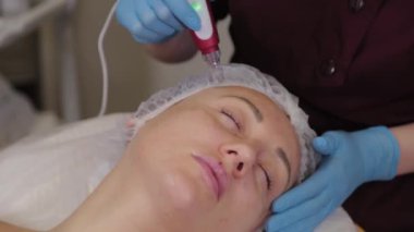 Professional beautician woman performs micronidling facial skin.