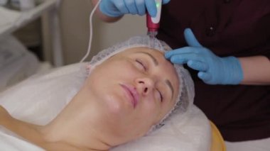 Professional beautician woman performs micronidling facial skin.