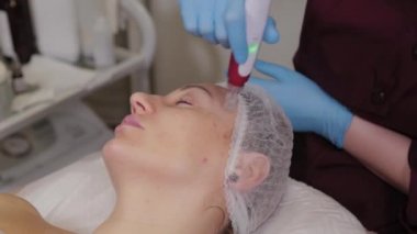 Professional beautician woman performs micronidling facial skin.