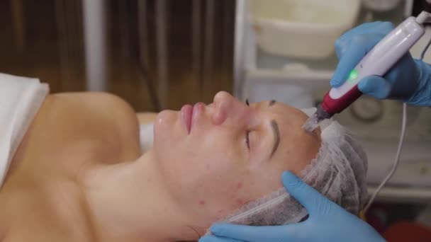 Professional beautician woman performs micronidling facial skin. — Stok video