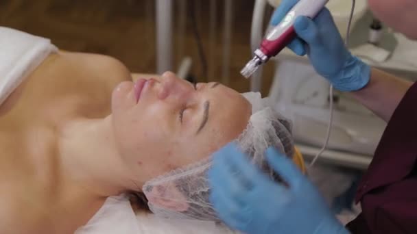 Professional beautician woman performs micronidling facial skin. — Stok video