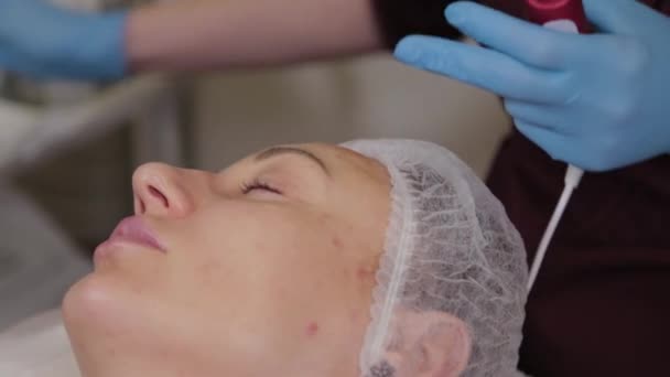 Professionele schoonheidsspecialiste vrouw voert micronidling gezichtshuid. — Stockvideo