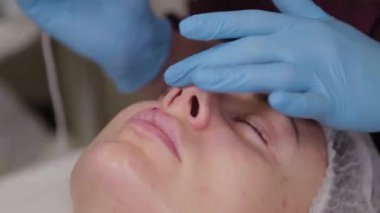 Professional beautician woman performs micronidling facial skin.