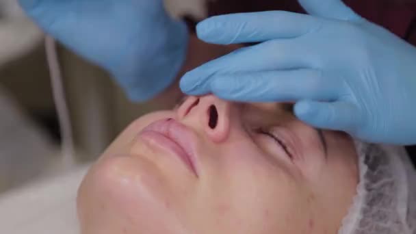 Estetista professionista donna esegue micronidling pelle del viso . — Video Stock