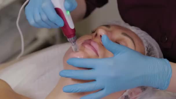 Professional beautician woman performs micronidling facial skin. — Stockvideo