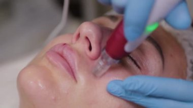 Professional beautician woman performs micronidling facial skin.