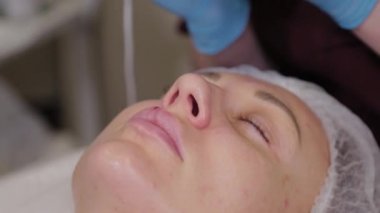 Professional beautician woman performs micronidling facial skin.