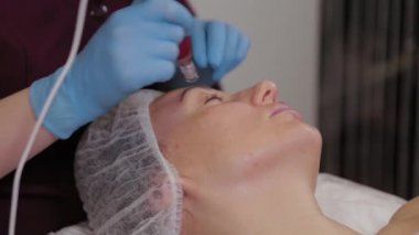 Professional beautician woman performs micronidling facial skin.