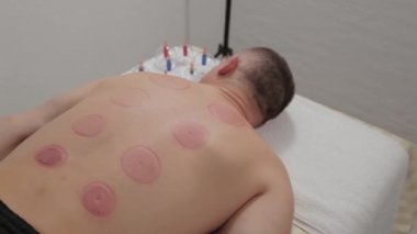 Elektrikli süpürge ameliyatından sonra bir adam kanepede yatar..