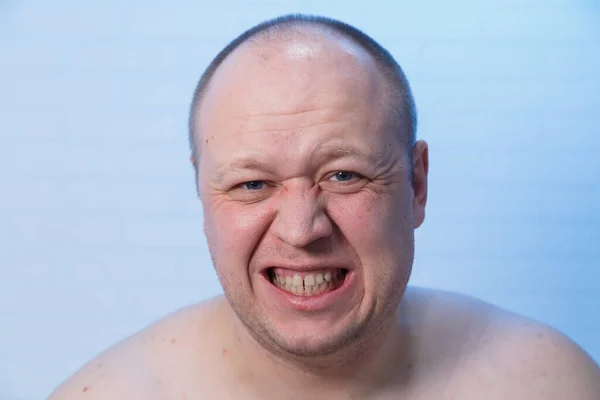 Retrato de un hombre calvo que se retuerce de dolor . —  Fotos de Stock