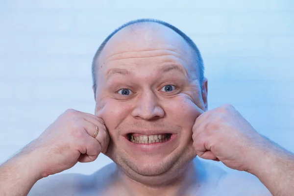 Πορτρέτο ενός φαλακρού που τεντώνει τα μάγουλά του. — Φωτογραφία Αρχείου