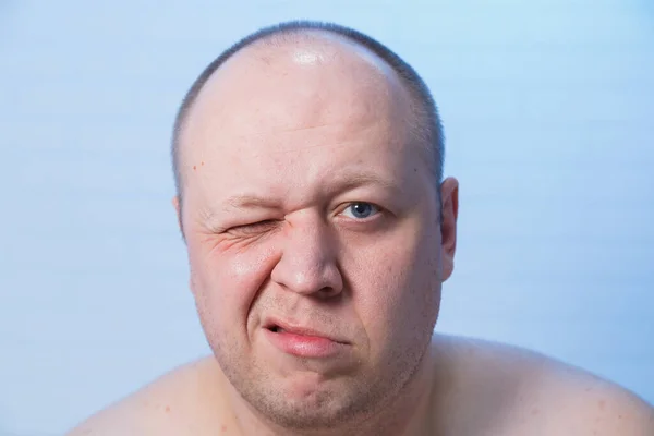 Portrait of a bald man who narrowed his eyes. — Stock Photo, Image