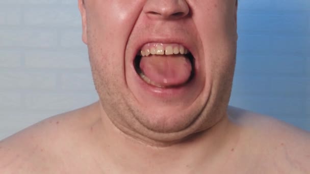 Portret łysego mężczyzny grymaszącego przed kamerą film spowolnionego ruchu. — Wideo stockowe