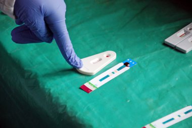 Laboratuvar analiz AIDS virüsü tan pomerini Köyü