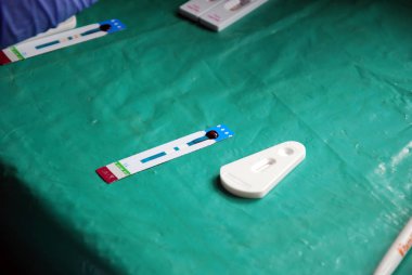 Laboratuvar analiz AIDS virüsü tan pomerini Köyü