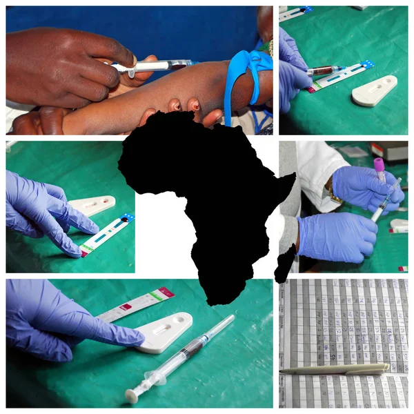 The HIV virus in Africa - Laboratory analysis of the AIDS virus — Stock Photo, Image