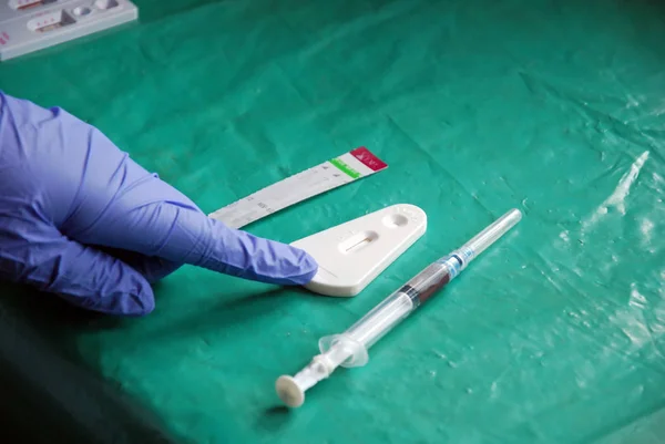 Лабораторный анализ вируса СПИДа в деревне Померини в Тане — стоковое фото
