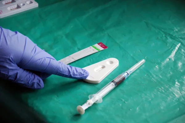 Лабораторный анализ вируса СПИДа в деревне Померини в Тане — стоковое фото