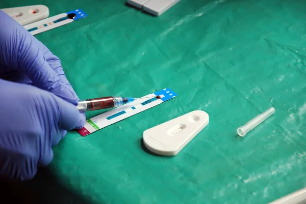 Laboratorium analizy wirusa HIV w wiosce pomerini w tan — Zdjęcie stockowe