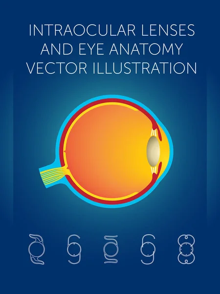 Lentes intraoculares e ilustración de vectores de anatomía ocular — Vector de stock