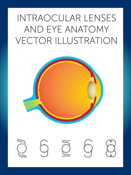 Lentes intraoculares e ilustración de vectores de anatomía ocular — Vector de stock