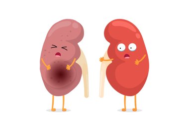 Üzgün, hasta ve sağlıklı, hayatta kalan böbrek karakterleri. İnsan anatomisi üreme sistemi içsel sağlıksız ağlama ve güçlü organ karşılaştırması. Vektör çizgi film illüstrasyonu