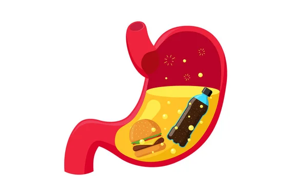 Mangiare malsano fast food hamburger soda e succo gastrico nello stomaco. Problemi di indigestione dell'apparato digerente umano. Illustrazione vettoriale — Vettoriale Stock