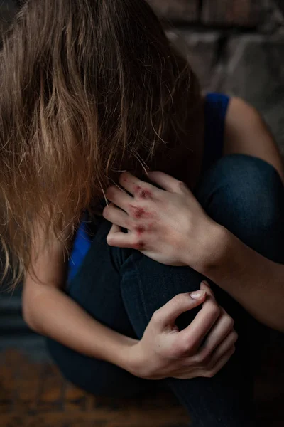 Femeia tristă victimă a violenței domestice și a abuzului stă pe podea cu vânătăi și răni pe mâini. Closeup . — Fotografie, imagine de stoc