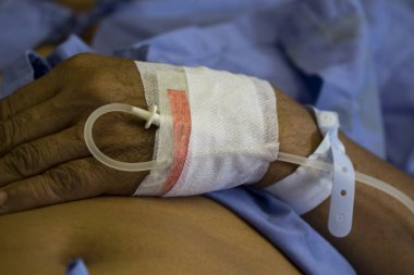 Tuzlu çözüm, hasta tedavi, hastalık, tıbbi cihaz, Sali