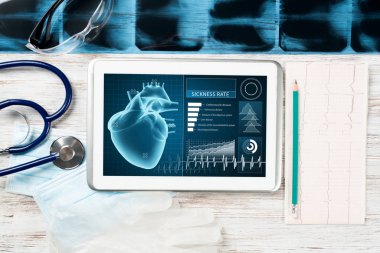 Modern hastanede tıbbi teşhisler. Ekranda tıbbi uygulama arayüzü olan tablet bilgisayar. Tahta masadaki röntgen, stetoskop ve kardiyogram. Klinikte dijital teknoloji.