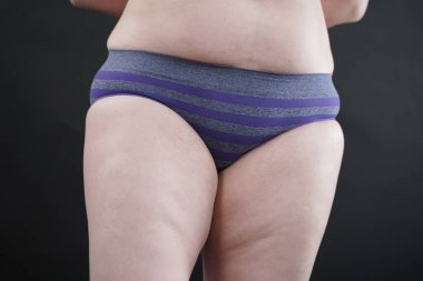 Artı boy kadın vücudunu selülit izleriyle ve saçlarıyla gösteriyor ve kendini sevmen ve kabullenmen için seni cesaretlendiriyor. Stüdyoda siyah arkaplan