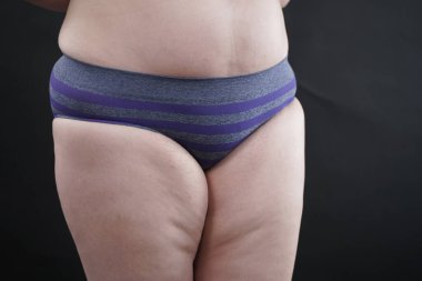 Artı boy kadın vücudunu selülit izleriyle ve saçlarıyla gösteriyor ve kendini sevmen ve kabullenmen için seni cesaretlendiriyor. Stüdyoda siyah arkaplan