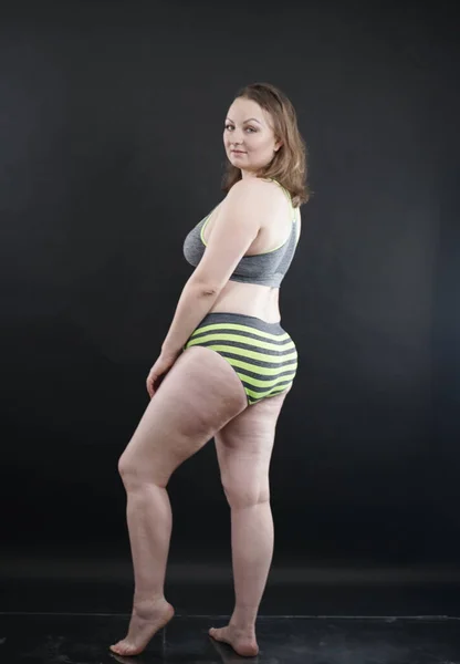 Size Woman Shows Her Body Stretch Marks Hair Cellulite Encourages