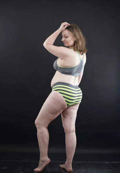 Mulher Size Mostra Seu Corpo Estrias Cabelo Com Celulite Incentiva — Fotografia de Stock