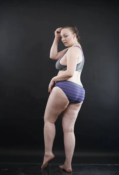 Size Woman Shows Her Body Stretch Marks Hair Cellulite Encourages — Stock Photo, Image