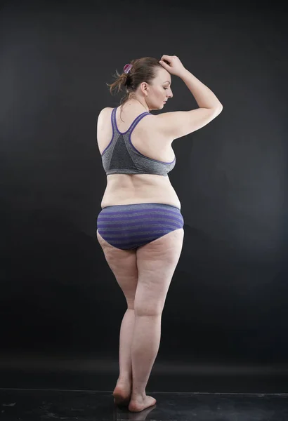 Mujer Talla Grande Muestra Cuerpo Estrías Cabello Con Celulitis Anima — Foto de Stock