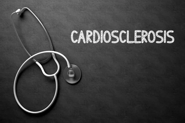 Cardiosclerosis kézírásos a Chalkboard. 3D illusztráció. — Stock Fotó