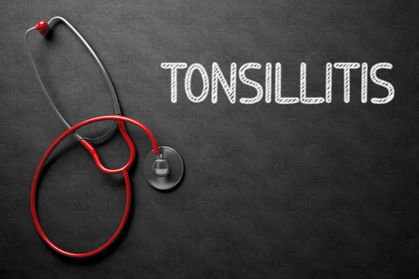 Tonsillitis - Текст на доске. 3D-моделирование . — стоковое фото