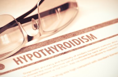 Hypothyroidism. Tıp. 3D çizim.
