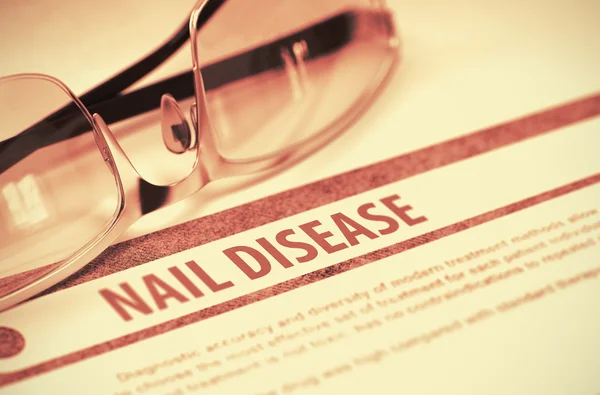 Diagnosis - Nail Disease. Medicine Concept. 3D Illustration. — Stock fotografie