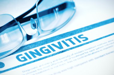 Tanı - Gingivitis. Tıp kavramı. 3D çizim.