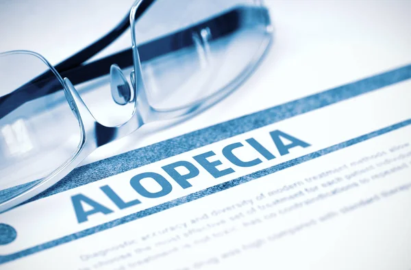 Diagnosztika - Alopecia. Gyógyászat fogalmát. 3D-s illusztráció. — Stock Fotó